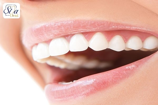 ارتودنسی و ایمپلنت روش های رایج اصلاح طرح لبخند