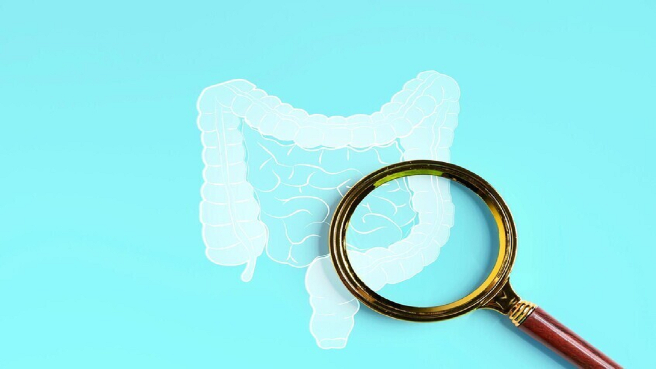 کشف ارتباط بین داروهای کلسترول و کاهش احتمال سرطان روده بزرگ