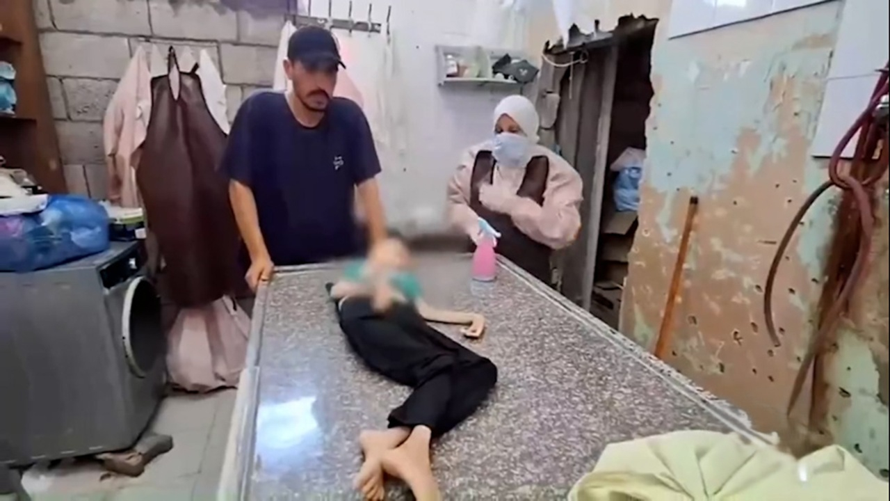 مرگ تلخ یک کودک فلسطینی دیگر بر اثر سوءتغذیه در غزه + فیلم