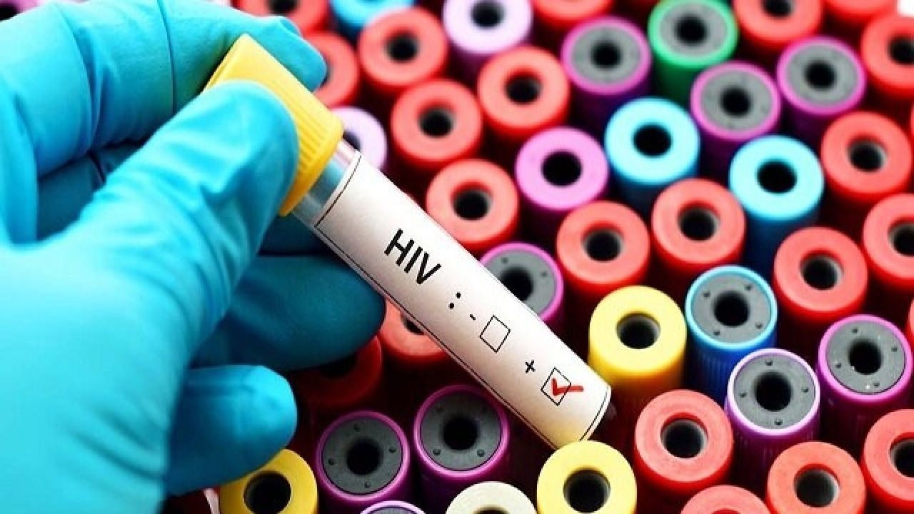 ادامه پویش «من هم تست HIV می‌دهم» در کشور تا ۲۰ آذرماه