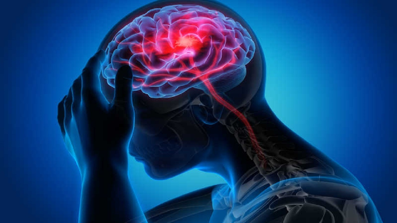 علائم سکته مغزی قریب الوقوع