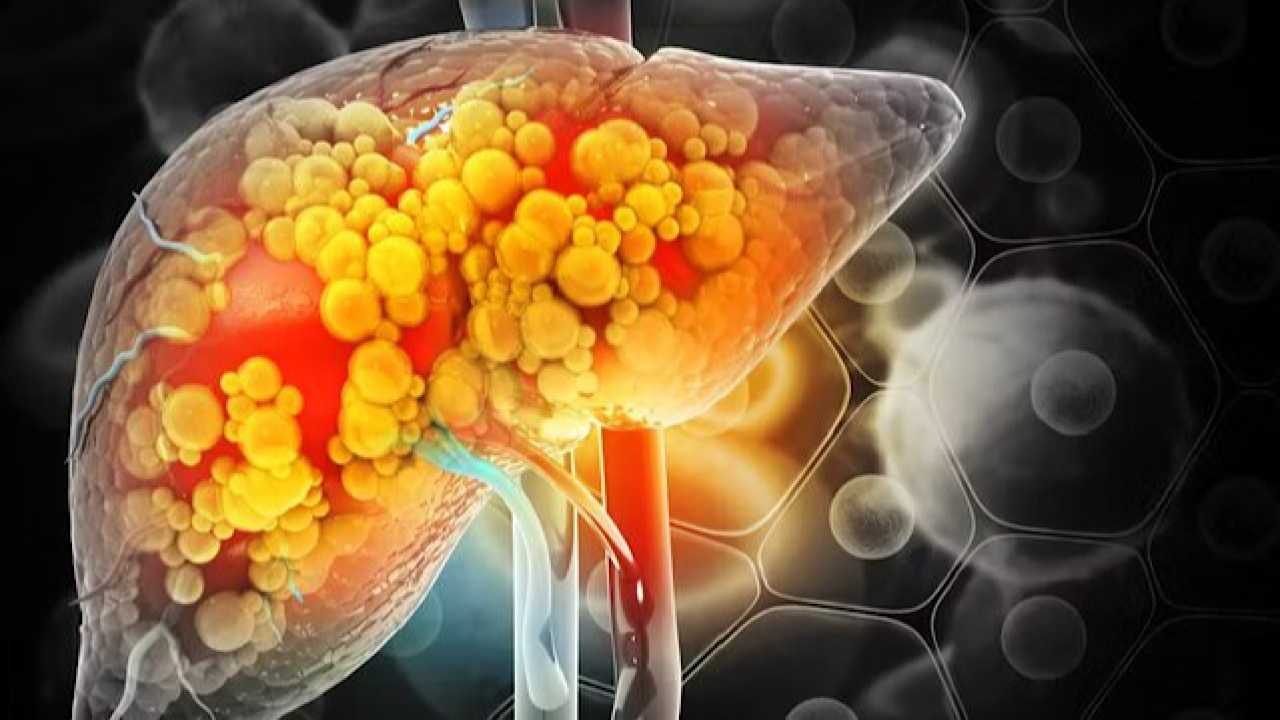 مصرف خودسرانه دارو‌ها از عوامل مهم آسیب به کبد