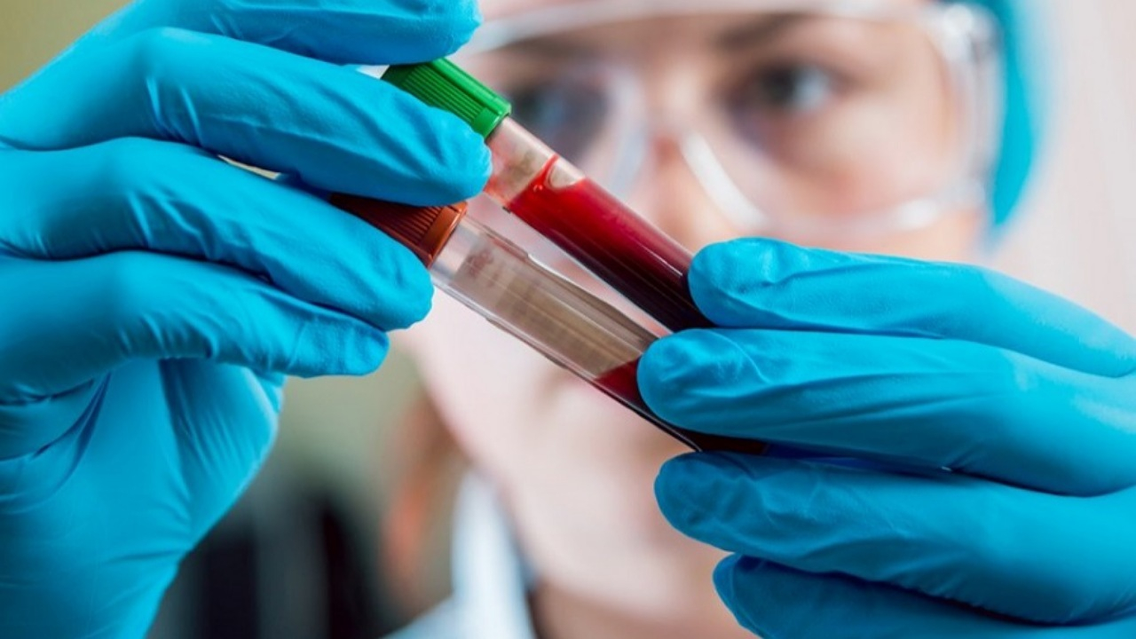 علائمی که ممکن است با کم‌خونی اشتباه گرفته شود + فیلم