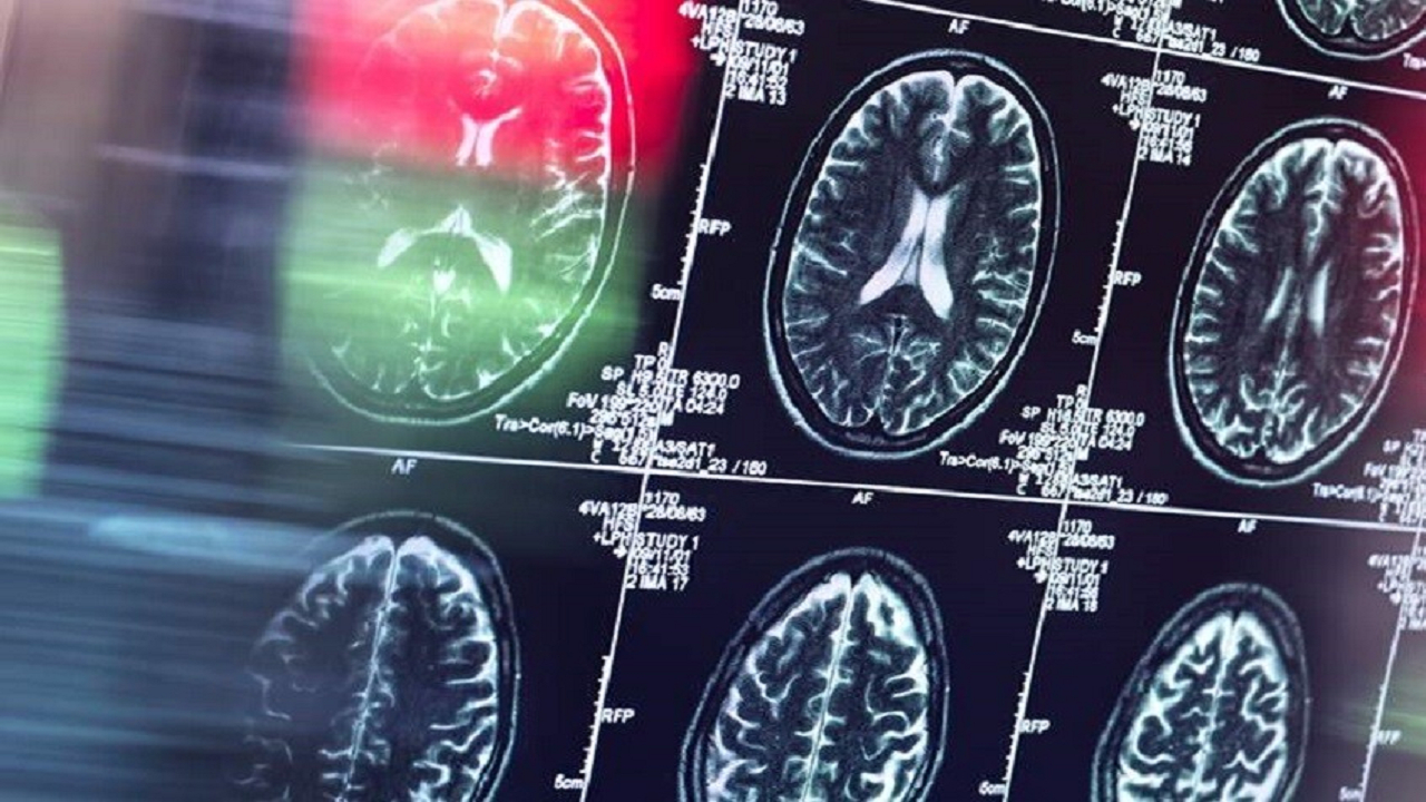 تأثیر عوامل روزانه بر شکلگیری عادت