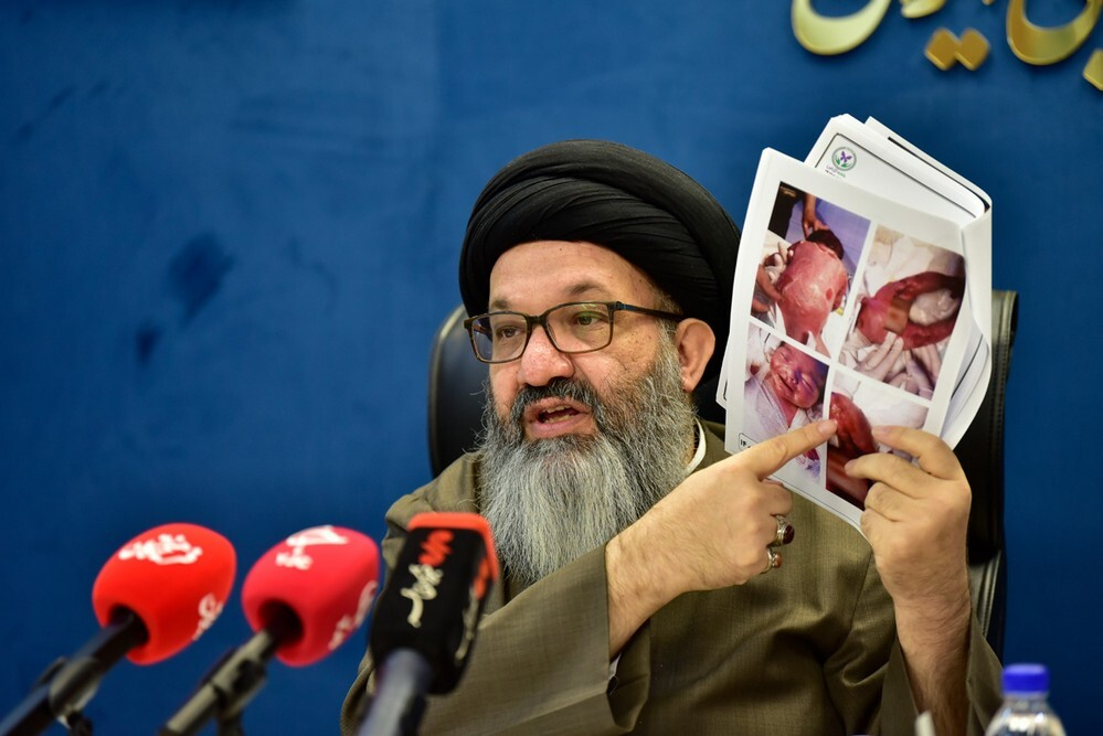 نشست خبری خانهایبی (مؤسسه حمایت از بیماران پروانهای)