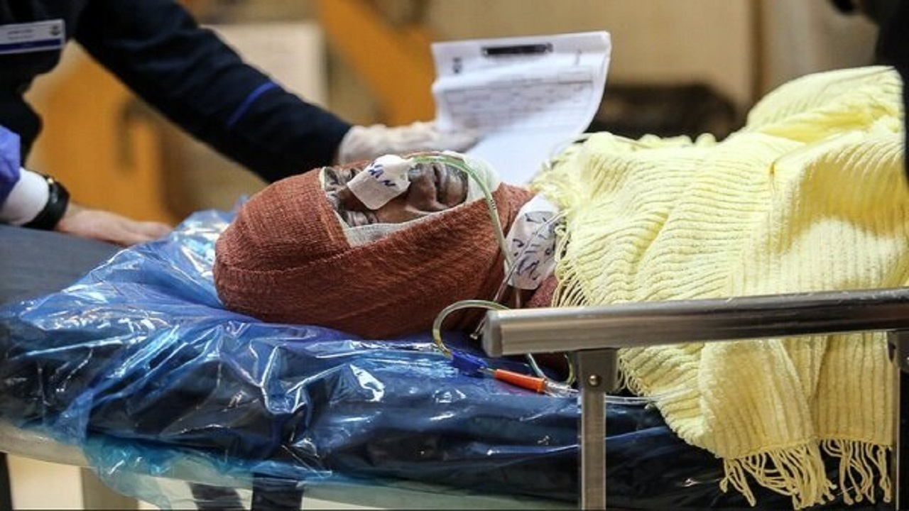 کمبود بیش از هزار تخت بیمارستانی سوختگی در کشور