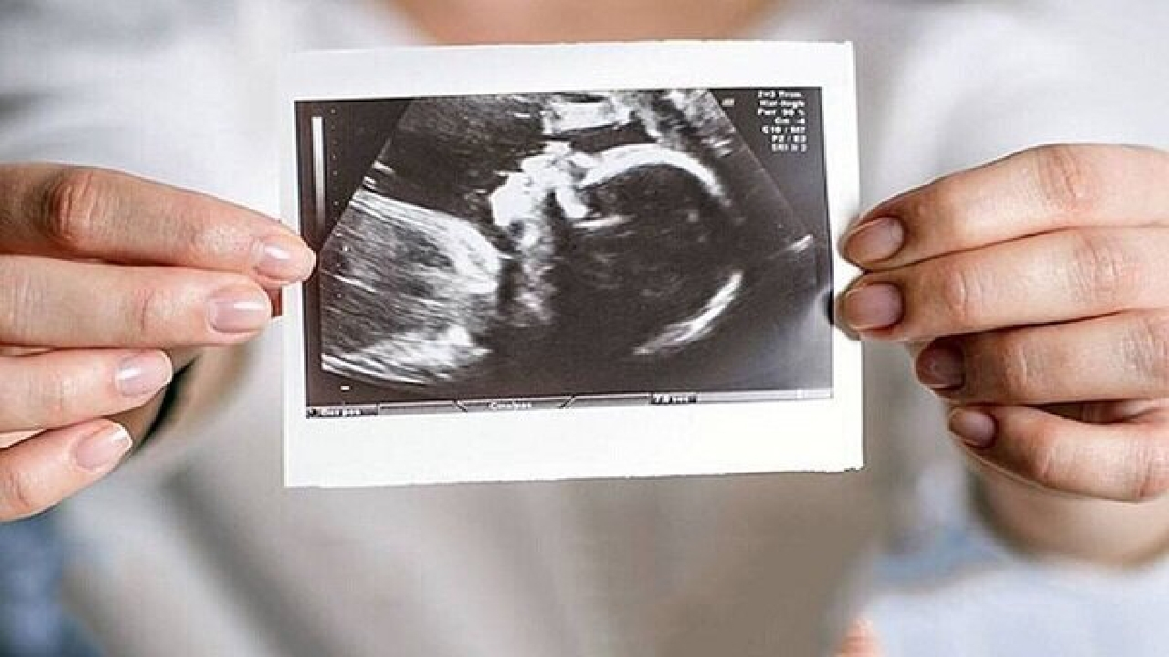 حمایت روانی، مهم‌ترین عامل تداوم بارداری است