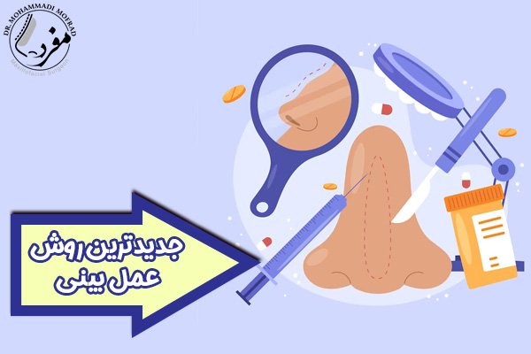 عمل بینی با جدیدترین روش توسط دکتر امیرحسین محمدی مفرد