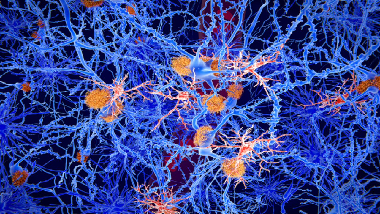 درمانی نوآورانه برای صرع که حافظه را بازیابی و از تشنج جلوگیری می‌کند