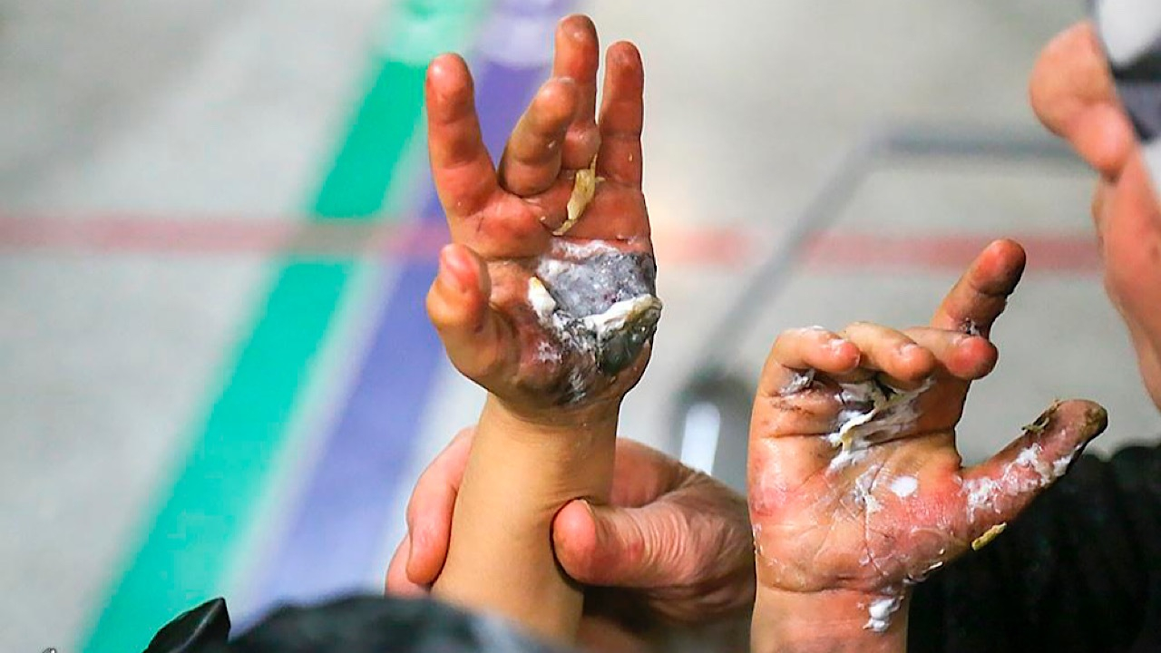 ۶ کشته و ۷۷۰ مصدوم در حوادث چهارشنبه سوری/ کوچکترین مصدوم نوزاد ۳ ماه بوده است